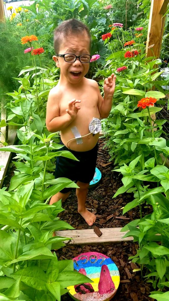 A child in a tall patch of zinnias, smiling. The child is wearing glasses and has a gastrostomy tube.